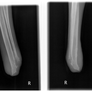 Röntgenbild Amputation Hund